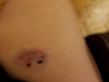 09